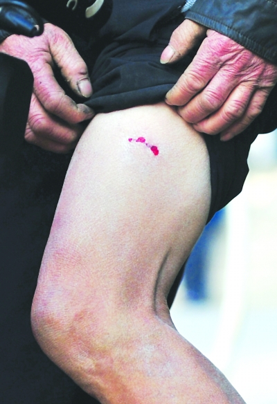 7小时一条疯狂黑狗鼓楼咬到建邺咬伤数十市民